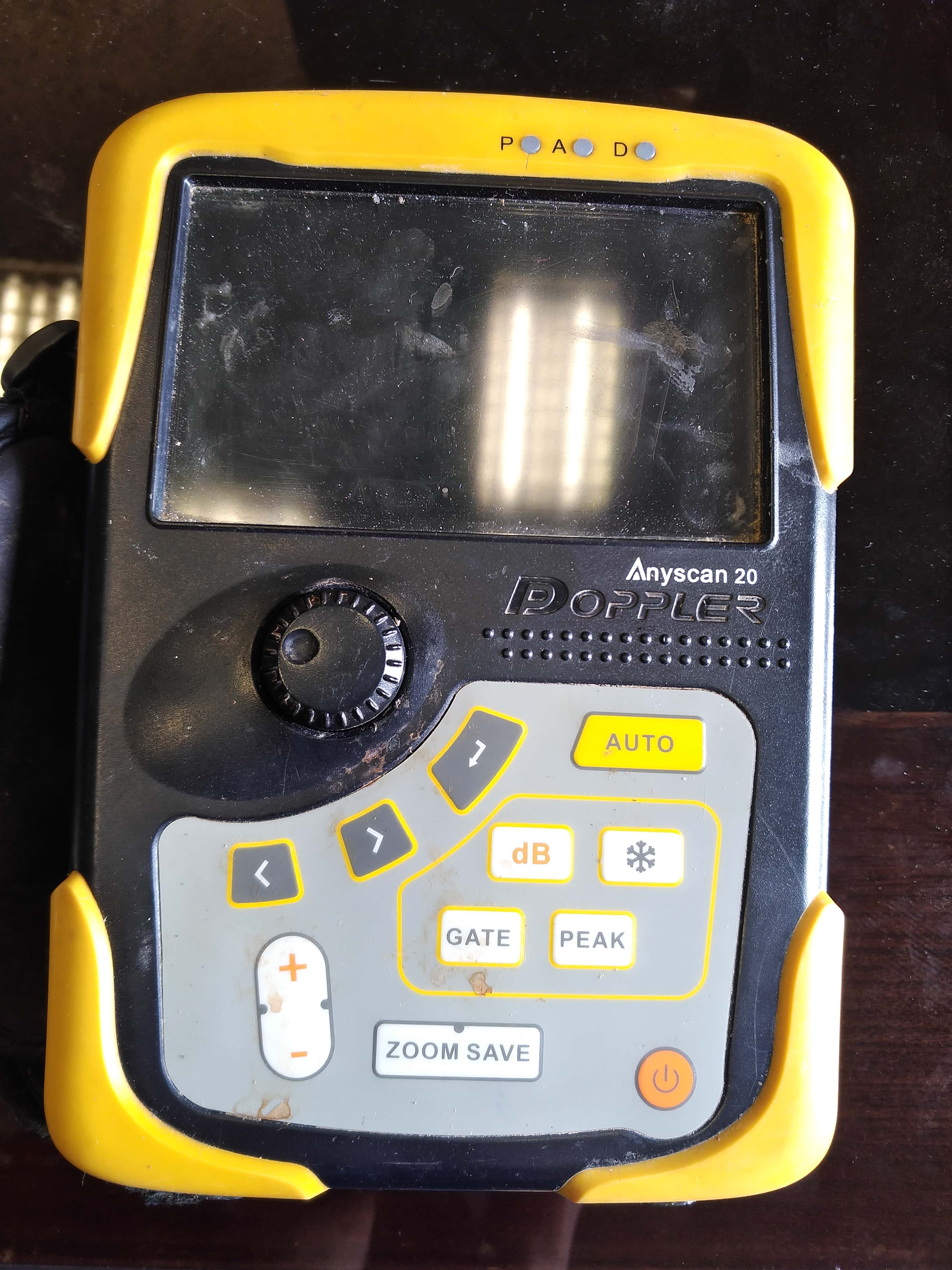 doppler anyscan20